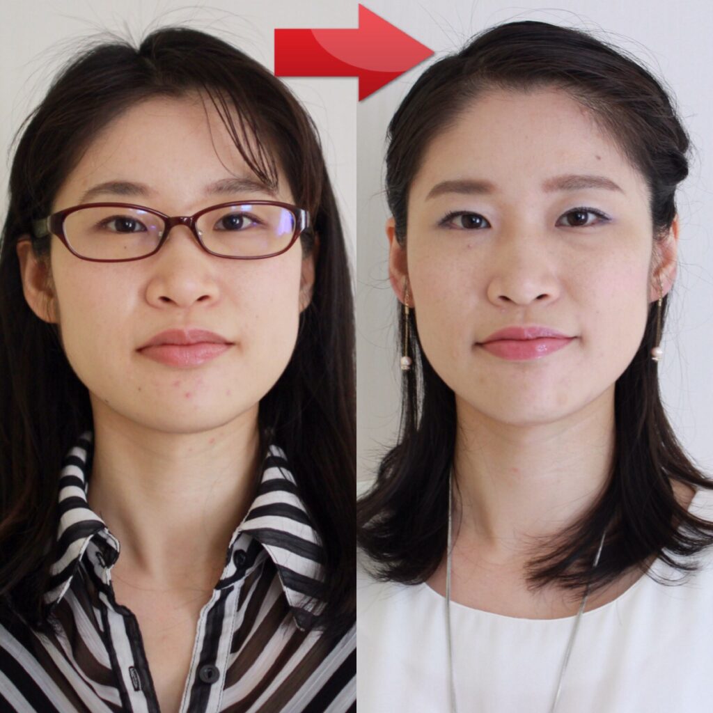 コンタクトビフォーアフター